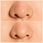 Before and after close-up of nose showing blackheads removed and pores visibly reduced after using the PoreClear pore vacuum